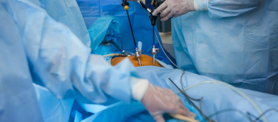 laparoscopia urológica laparoscopia urológica